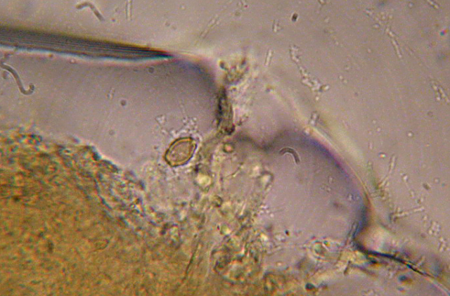 Microscopia e........MICRO funghi (muffe)