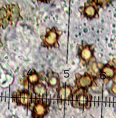 foto spore Inocybe asterospora