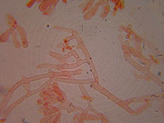 Corticioide  da identificare