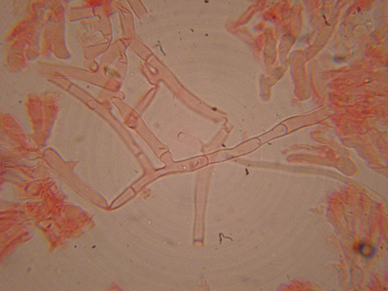 Corticioide  da identificare