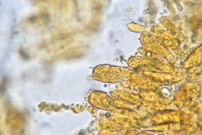 Presunta Tricholomella constricta
