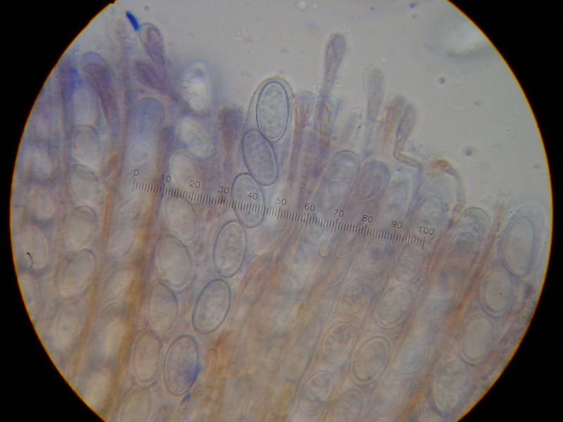 Scutellinia vitreola