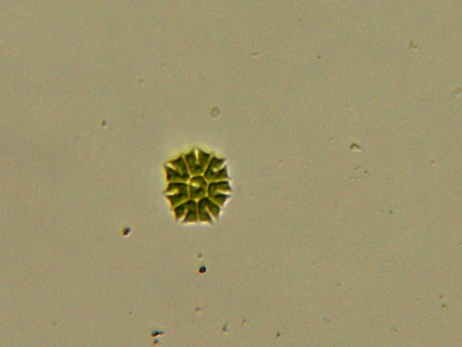 Pediatrum tetras, Cyclotella sp., Cocconeis sp.