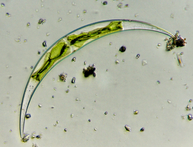 Closterium sp.