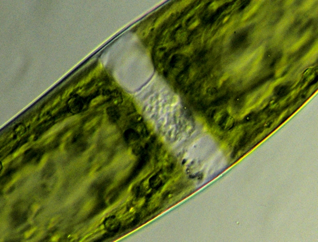 Closterium ehrenbergii