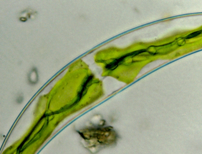 Closterium sp.