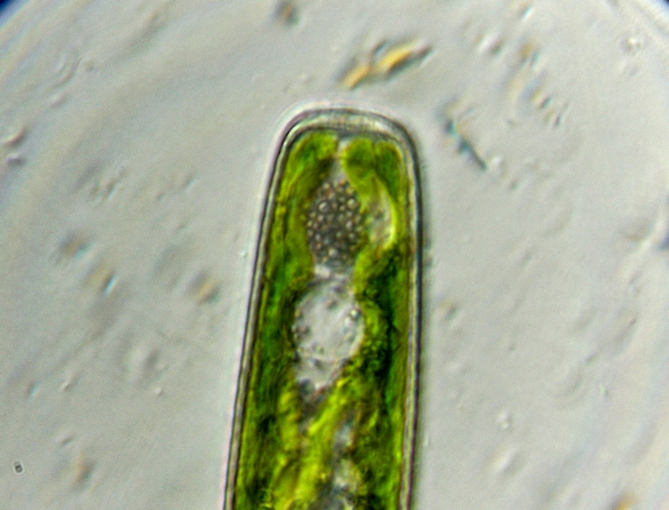 Pleurotaenium sp.