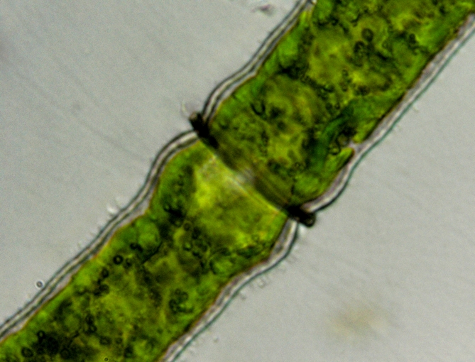 Pleurotaenium sp.