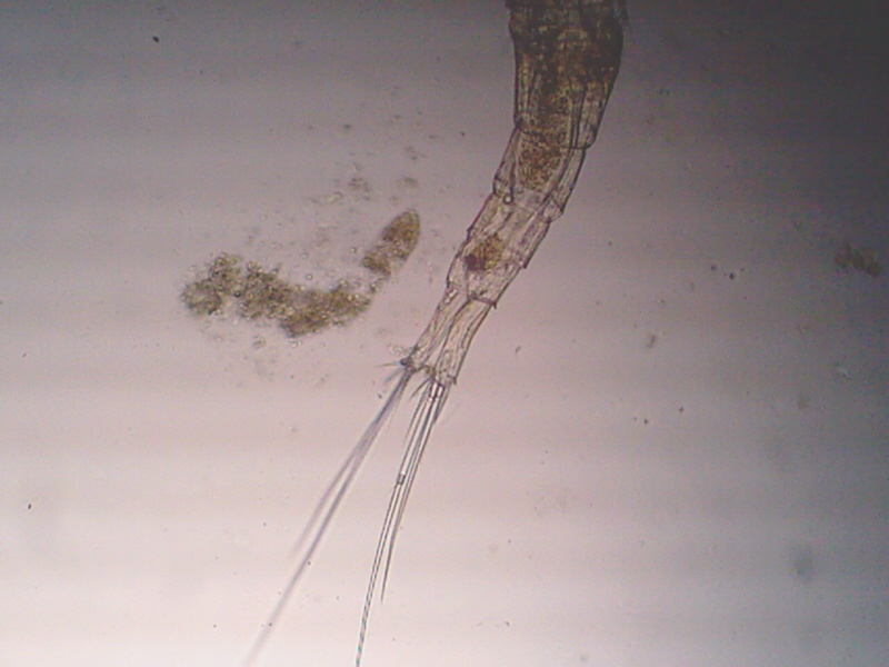 Telson di Copepode