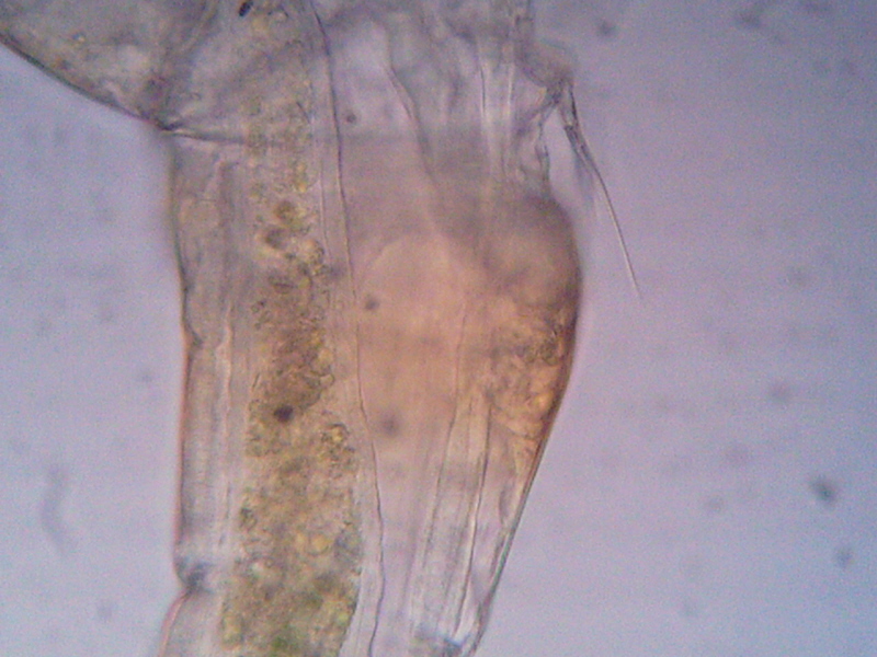 Telson di Copepode