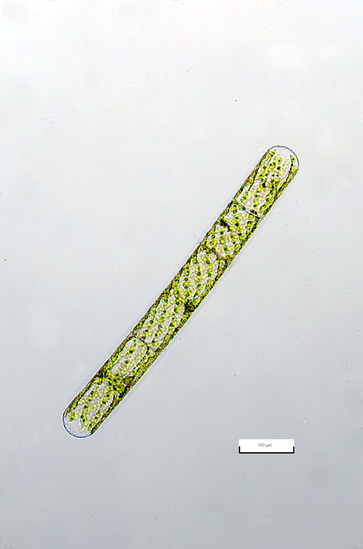 Spirogira (?)