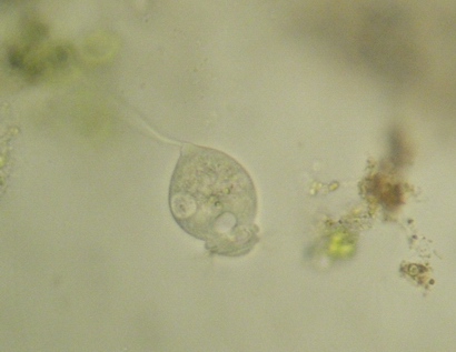 vorticella