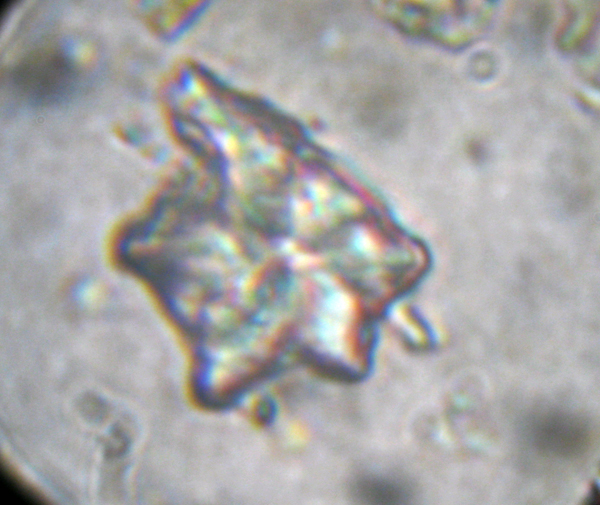 Discoasteraceae e Microfossili vari