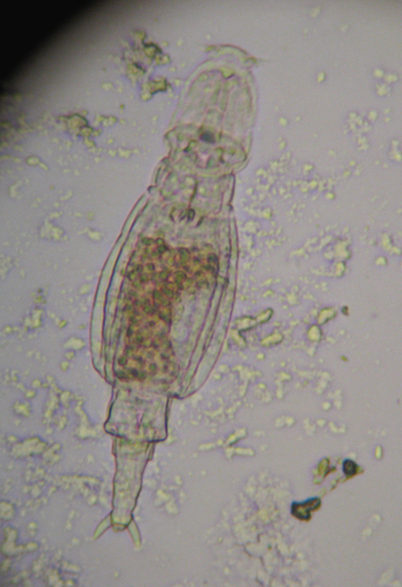 Rotifero: Adineta sp.?