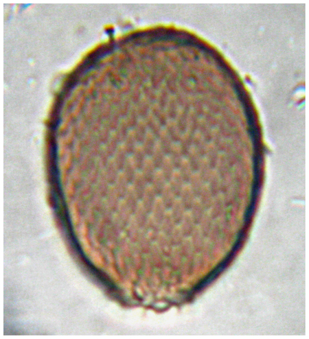 Tecameba: Assulina muscorum ?