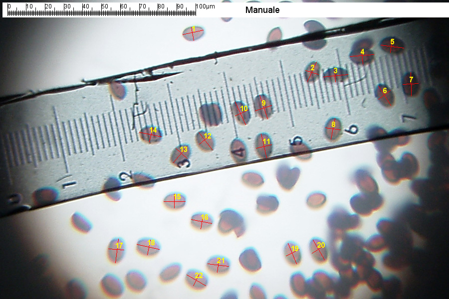 Due tentativi (miseri) di microscopia