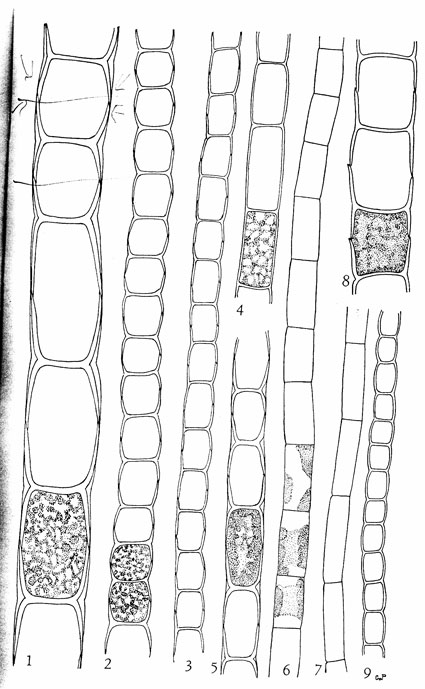 Spirogyra sp.