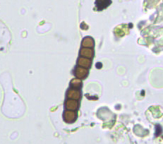 Mini-Guida all''identificazione delle spore Fungine