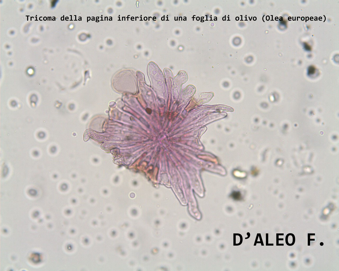 Tricoma della foglia di Olivo (Olea europeae)