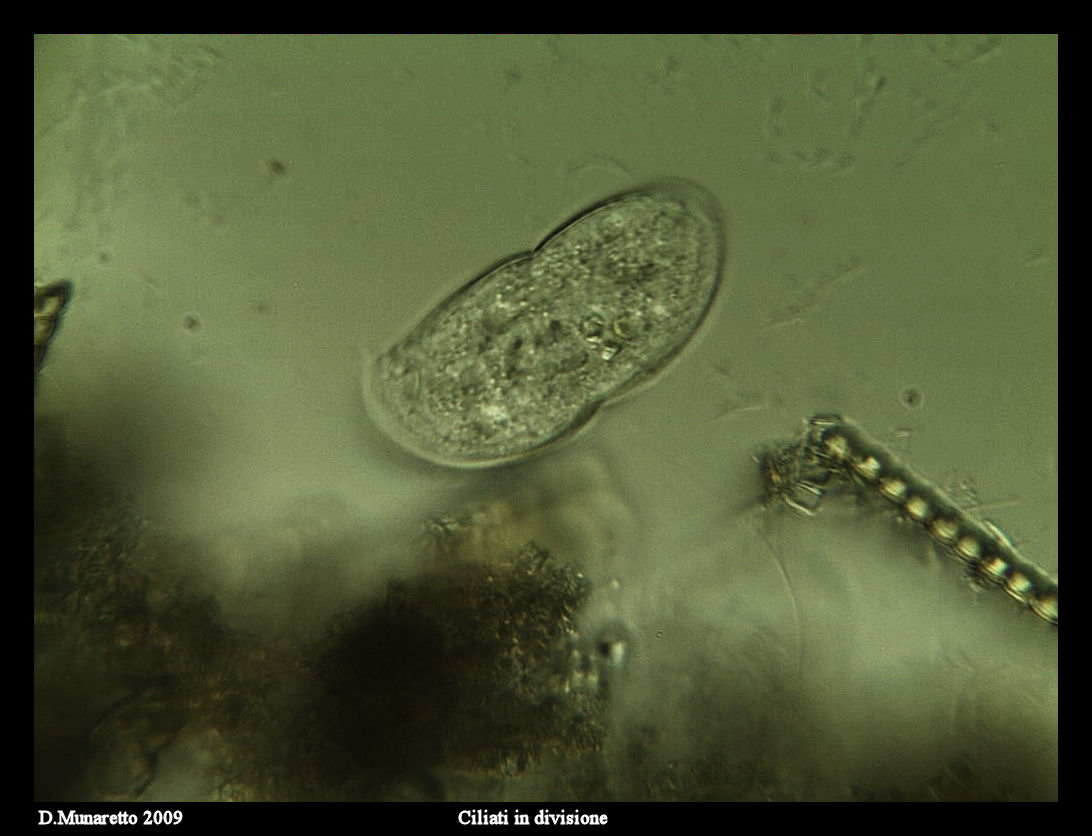 Ciliato in divisione...sequenza di immagini