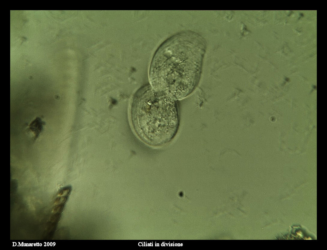 Ciliato in divisione...sequenza di immagini