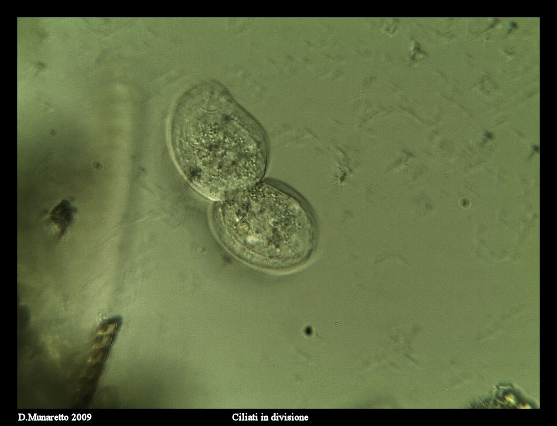 Ciliato in divisione...sequenza di immagini