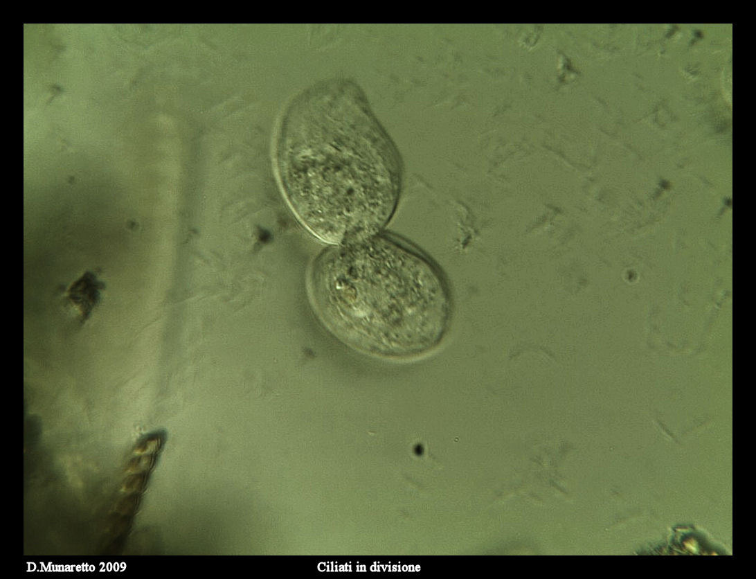 Ciliato in divisione...sequenza di immagini