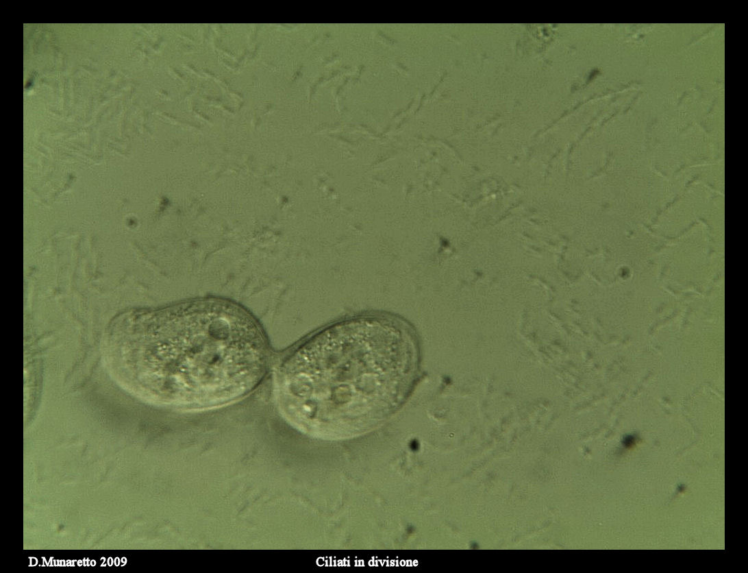 Ciliato in divisione...sequenza di immagini