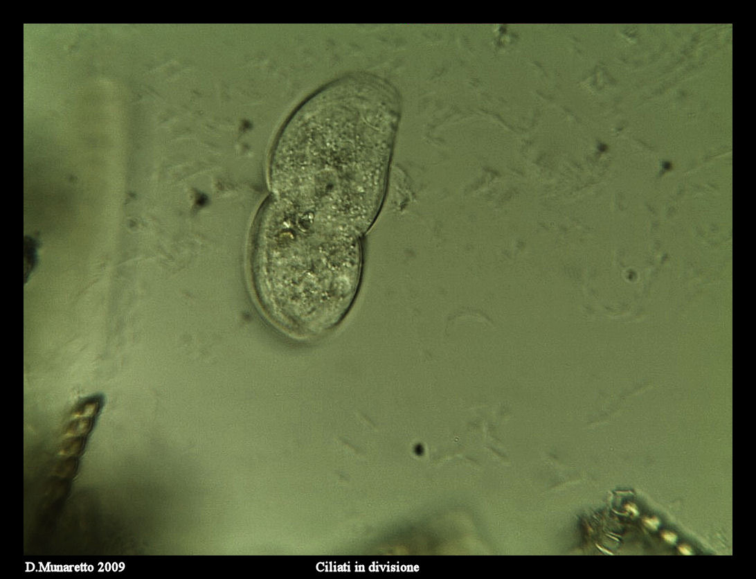 Ciliato in divisione...sequenza di immagini
