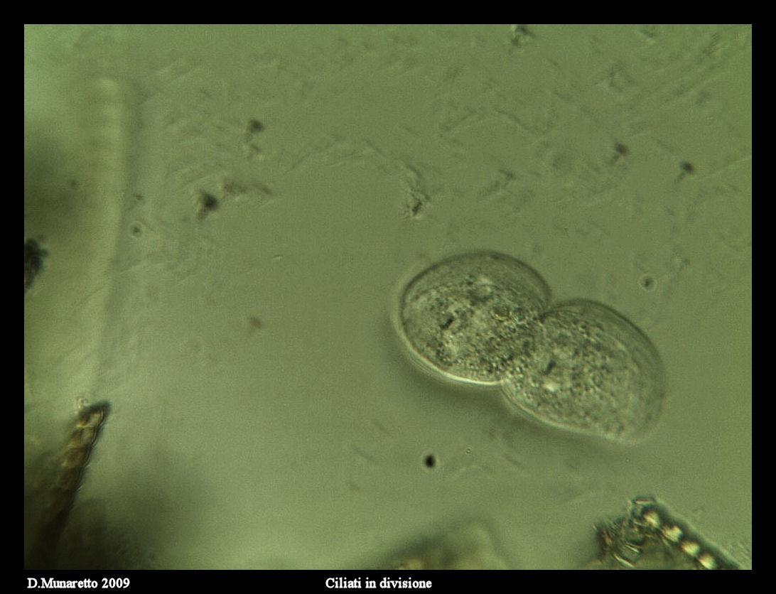 Ciliato in divisione...sequenza di immagini