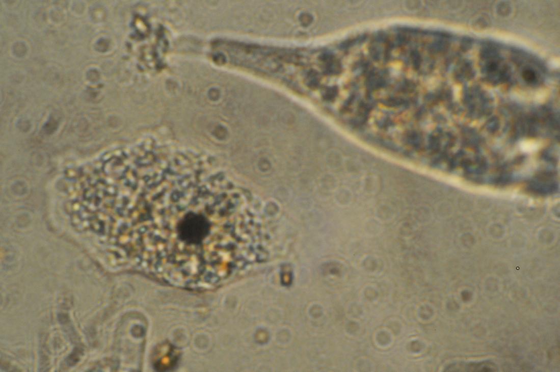 Ameba vs Vorticella