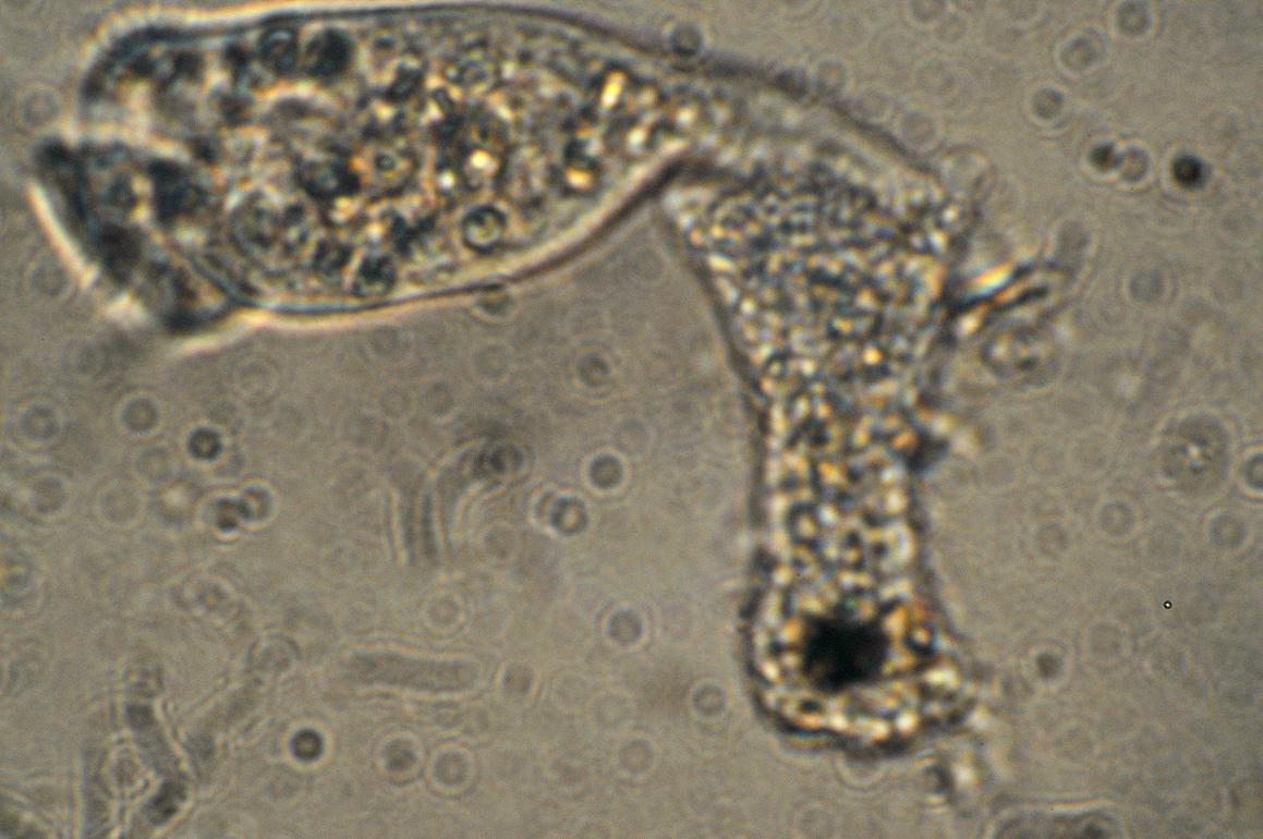 Ameba vs Vorticella