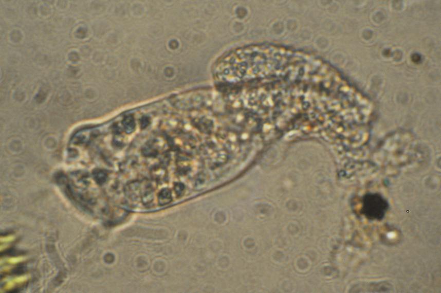 Ameba vs Vorticella