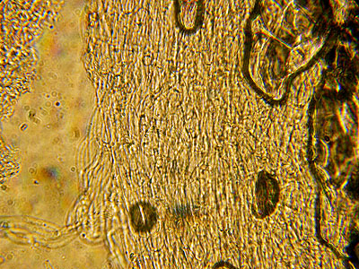 Il microscopio biologico invertito in micologia.