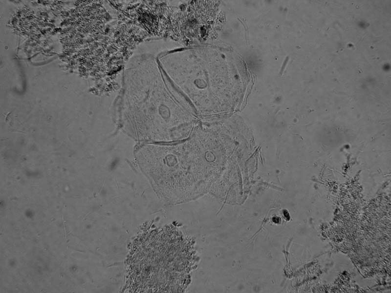 MISSIONE COMPIUTA !! - MICROSCOPIO ACQUISTATO