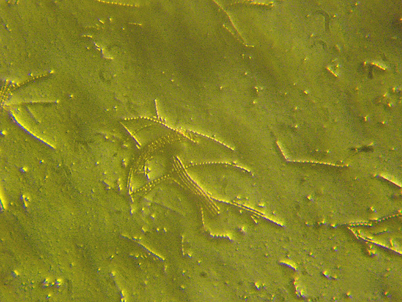 Tecniche inusuali nella microscopia micologica