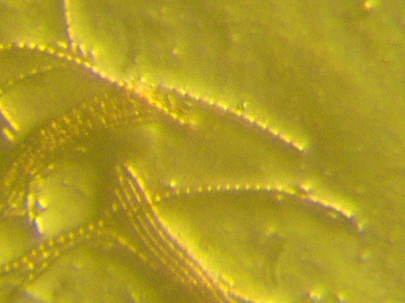 Tecniche inusuali nella microscopia micologica