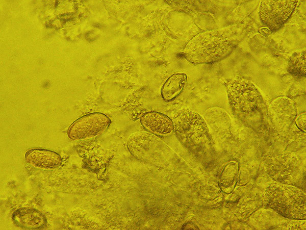 Il microscopio biologico invertito in micologia.