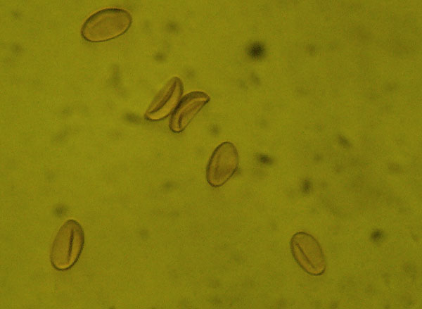 Il microscopio biologico invertito in micologia.