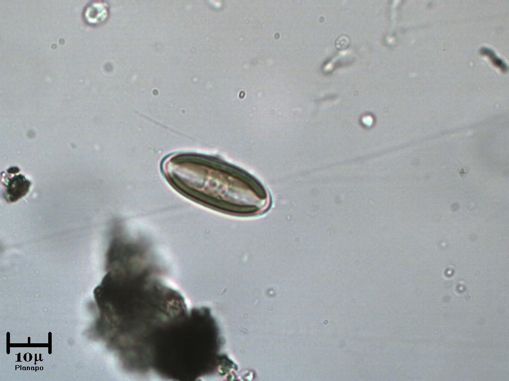 Microalga