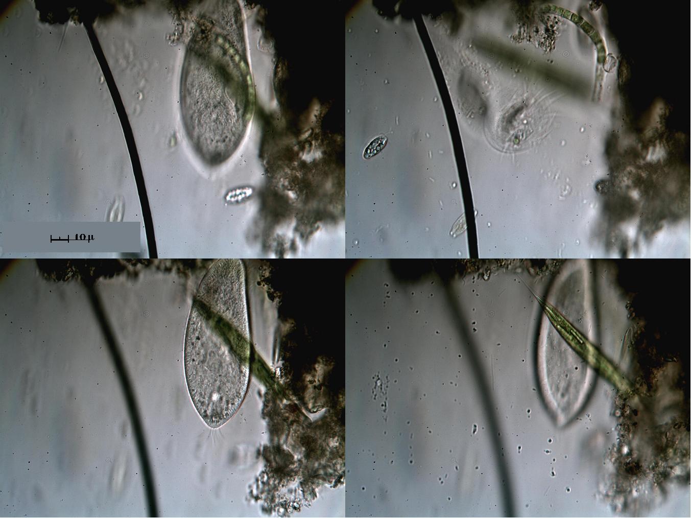 Alga nera con Aspidisca, Ciliato ed Euglena