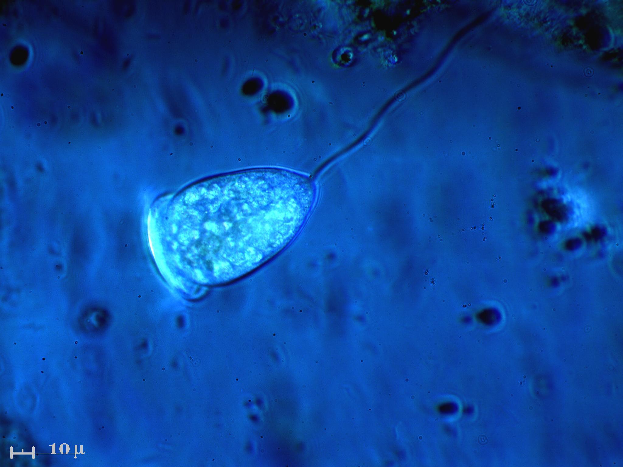 Vorticella in episcopia laterale