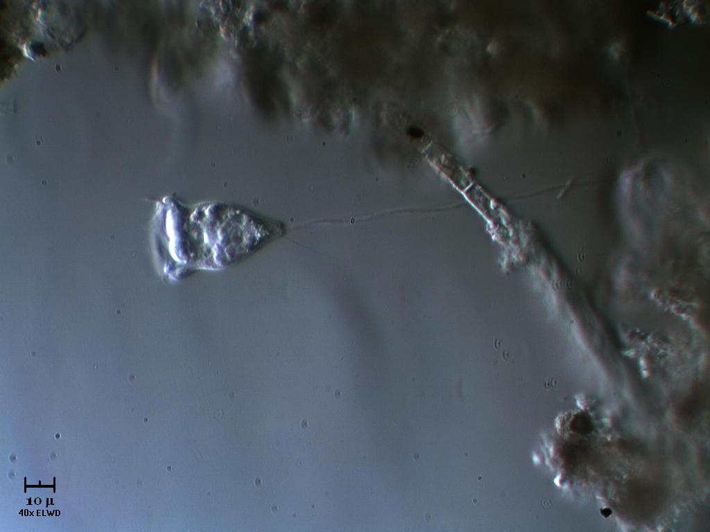 Vorticella