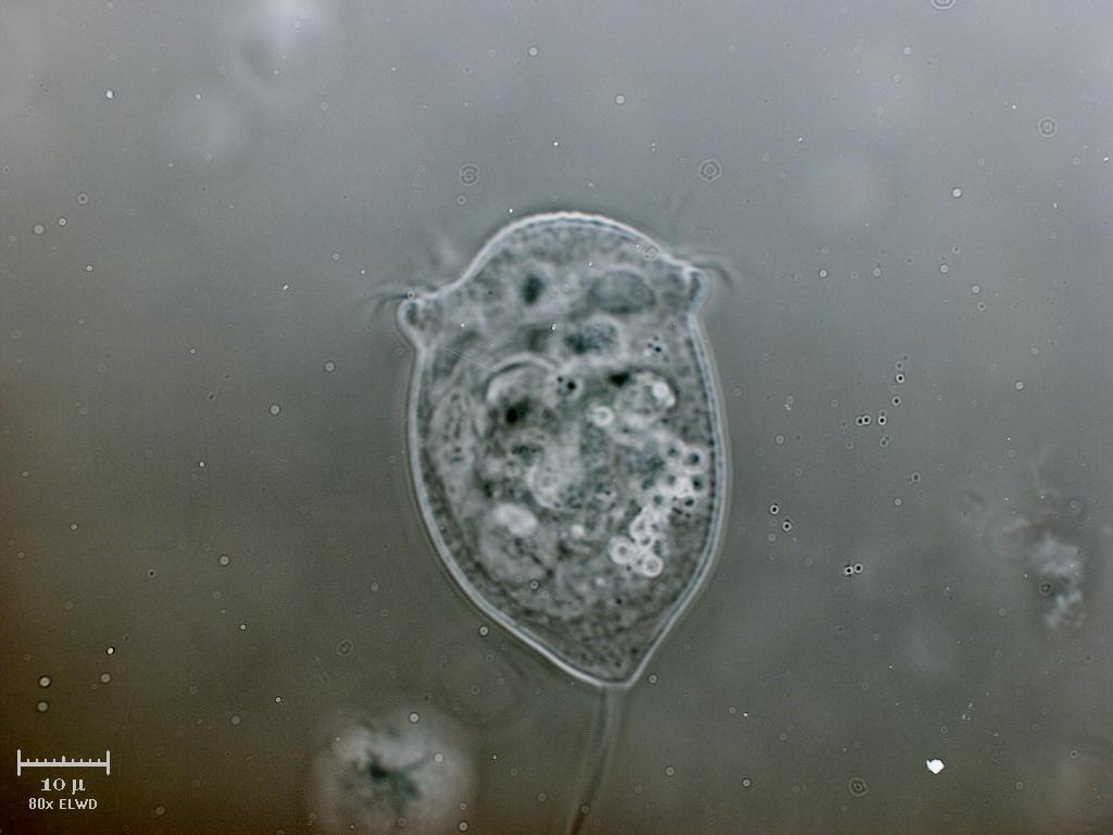 Vorticella