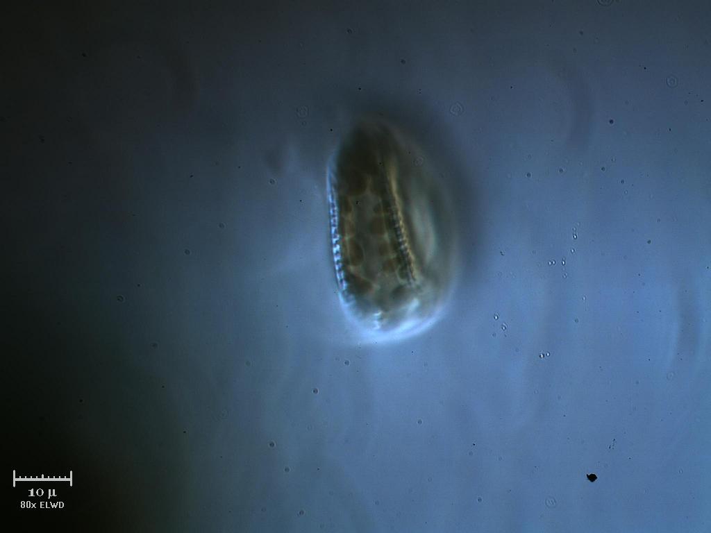 Surirella sp.