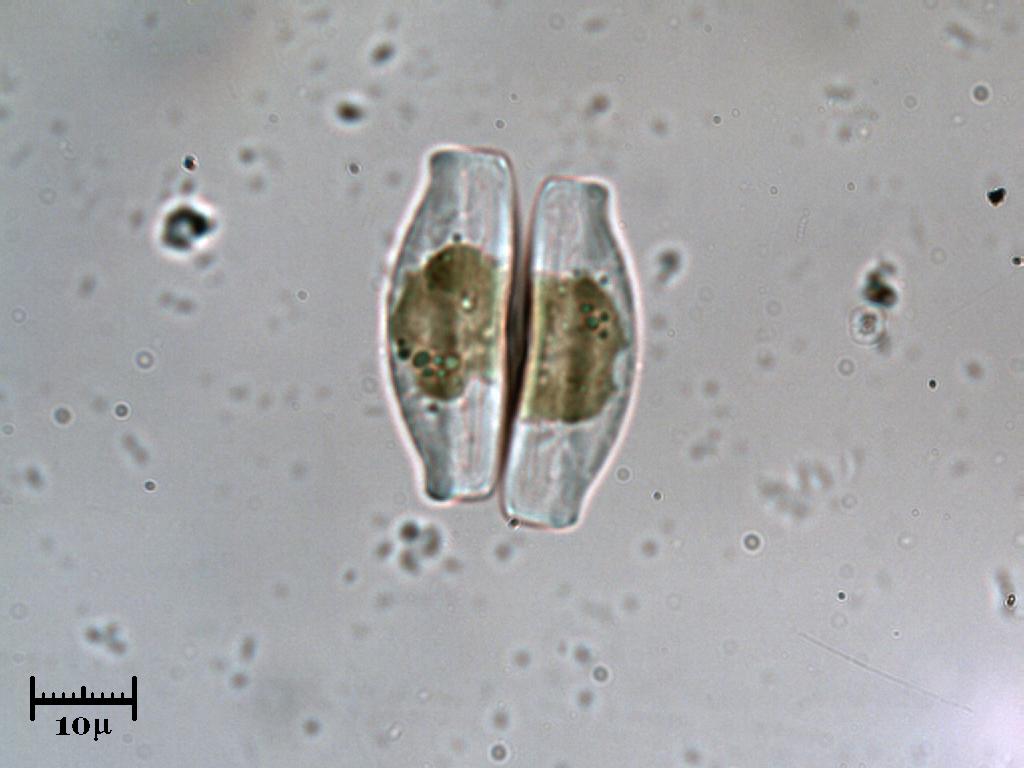 Diatomea VS diatomea