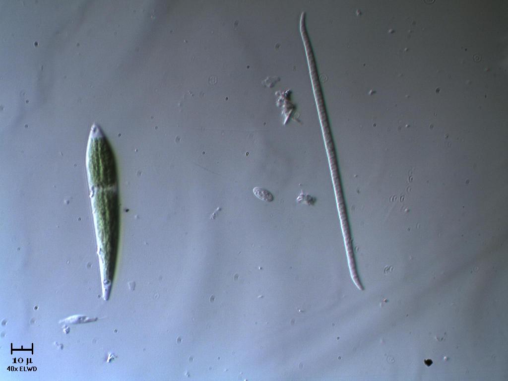 Cianobatterio & Closterium nano