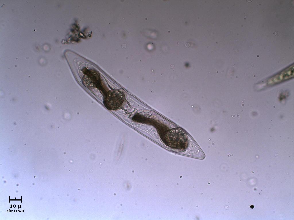 Closterium parassitato