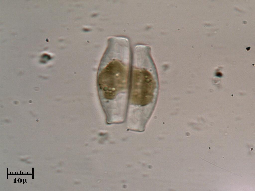 Diatomea VS diatomea