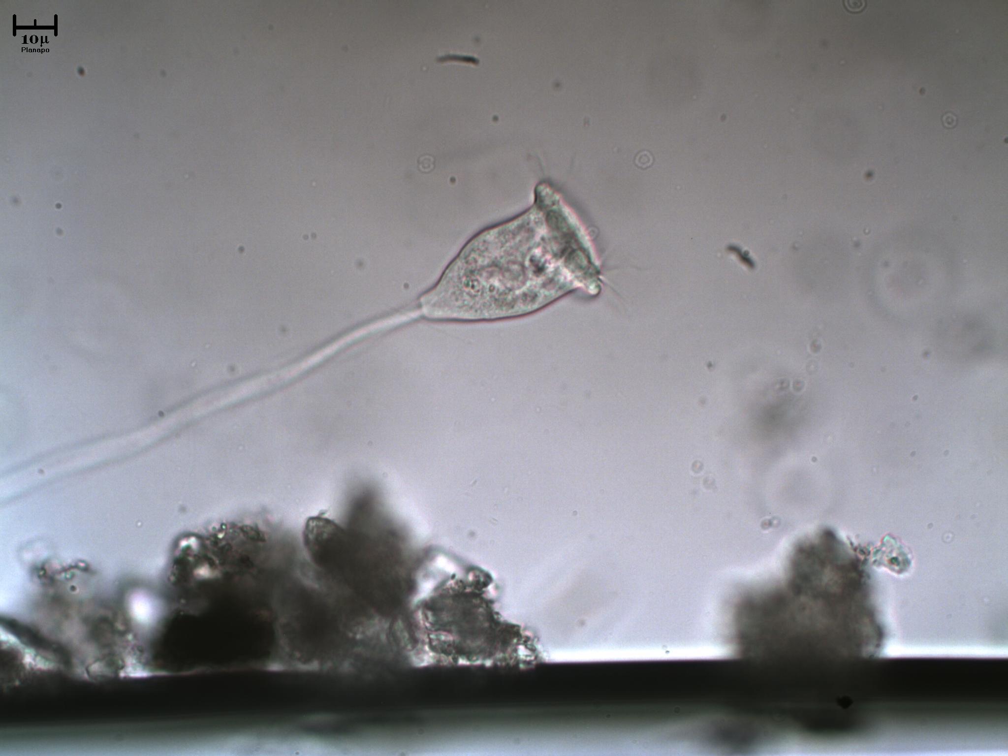 Vorticella